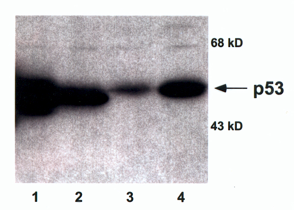 Western blot performance of A145P. 